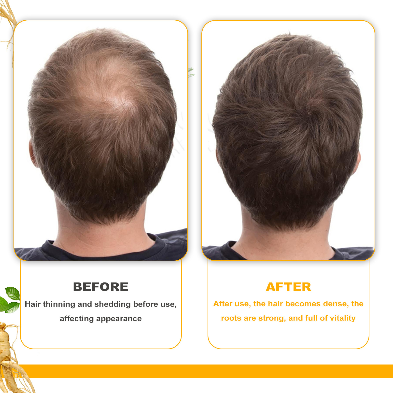 (Hair Essential Oil) EELHOE Biotin Hair Spray For Man Women Repair Damage Restore Oil Scalp Repair Serum Spray Thicken Hair Health Care Anti Hair Loss Hair Growth Treatment