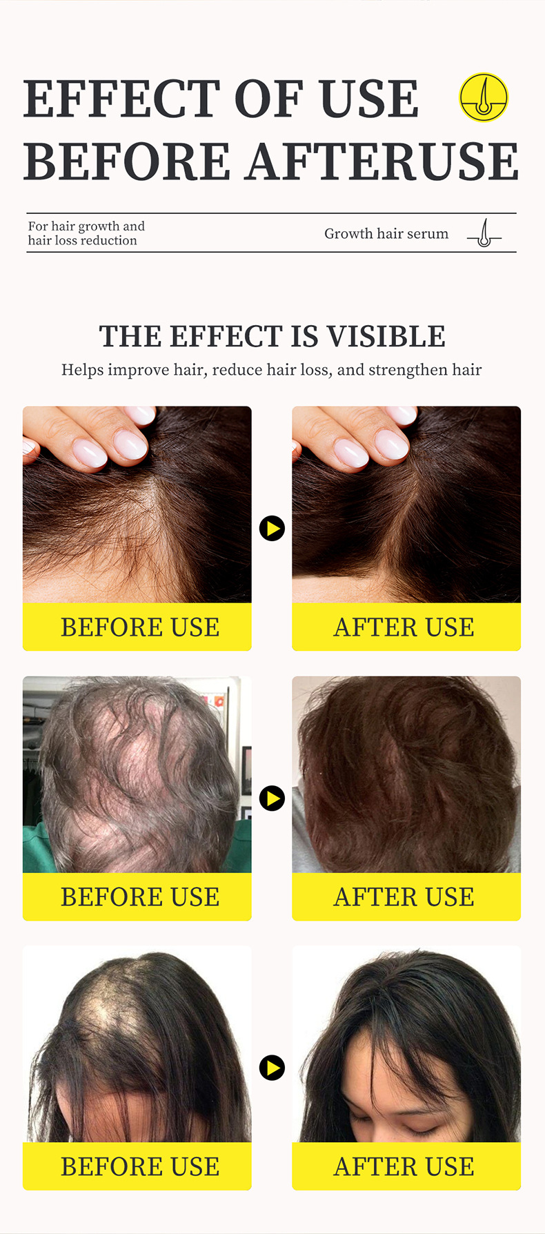 (1 PC) Dense Hair Growth Serum Hair Care Hair Growth Products Growing Hair Oil Hair Loss Care Liquid Beauty Hair Scalp Treatment Effective Baldness Repair Treatment