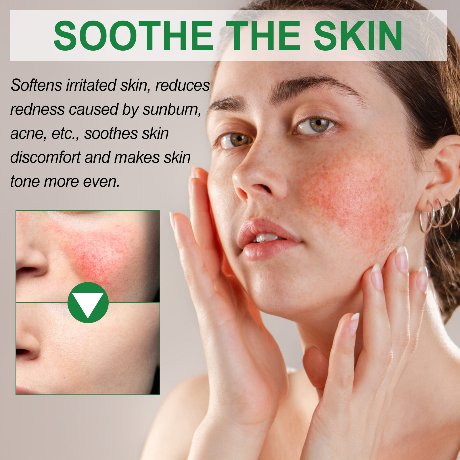Redness Repair Cream Relieve Sunburn Improve Dullness Whitening Skin Tone Corrector Strengthen Sensitive Anti Dark Spots Lotion