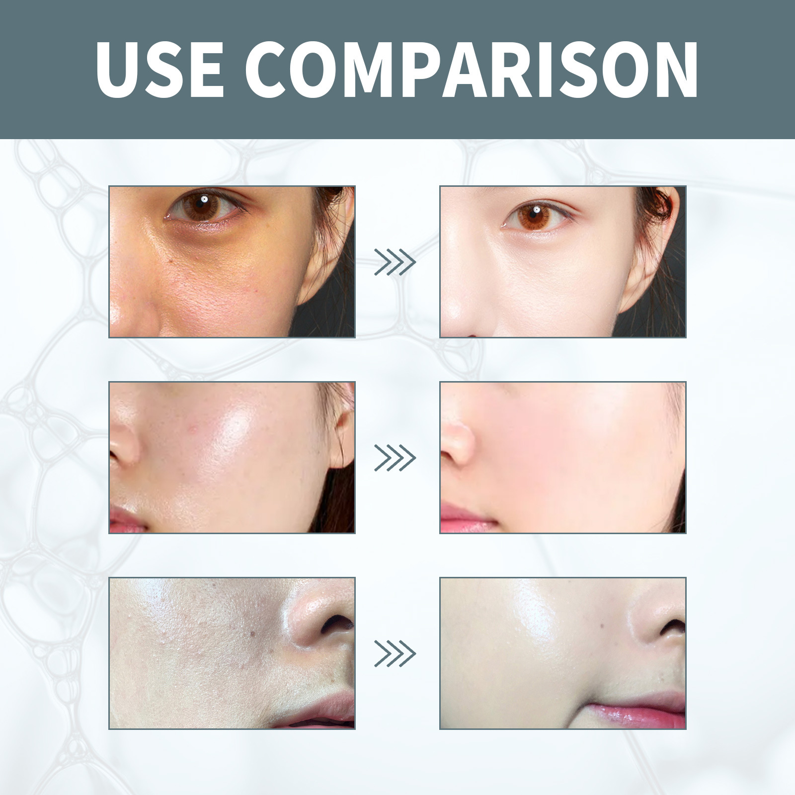 (1pc) EELHOE Hyaluronic Acid Moisturizing Serum Deep Nourish Smooth Skin Whiten Brighten Skin Care Products Hydrate Face Essence Firm Facial Skin Restores Dark Skin 35ml