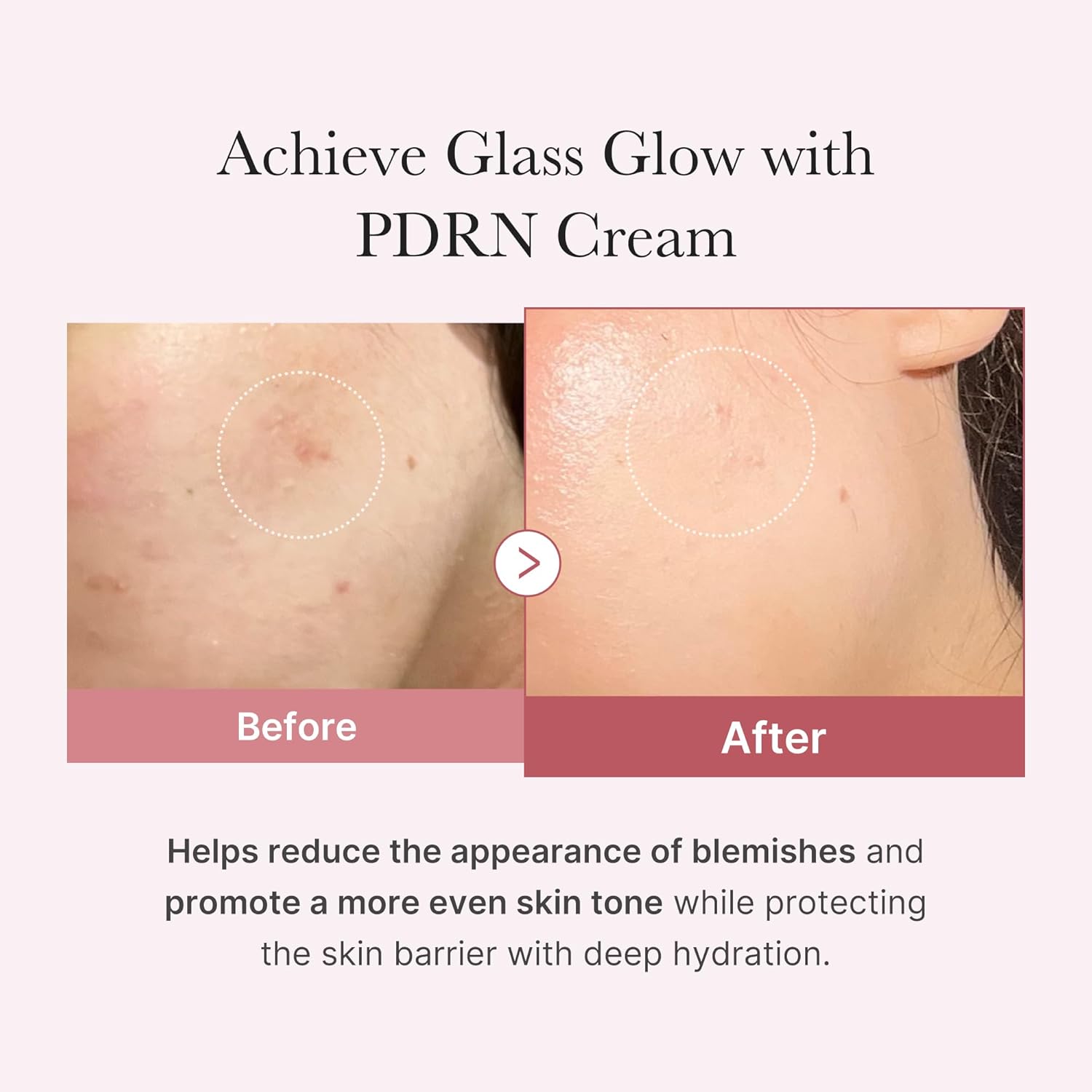 medicube Salmon DNA PDRN Pink Hyaluronic Moisture Cream Blemish Relief Hydrating Care Restore Skin Elasticity Glow Korean Skincare Even Skin Tone Pore Care 50ml