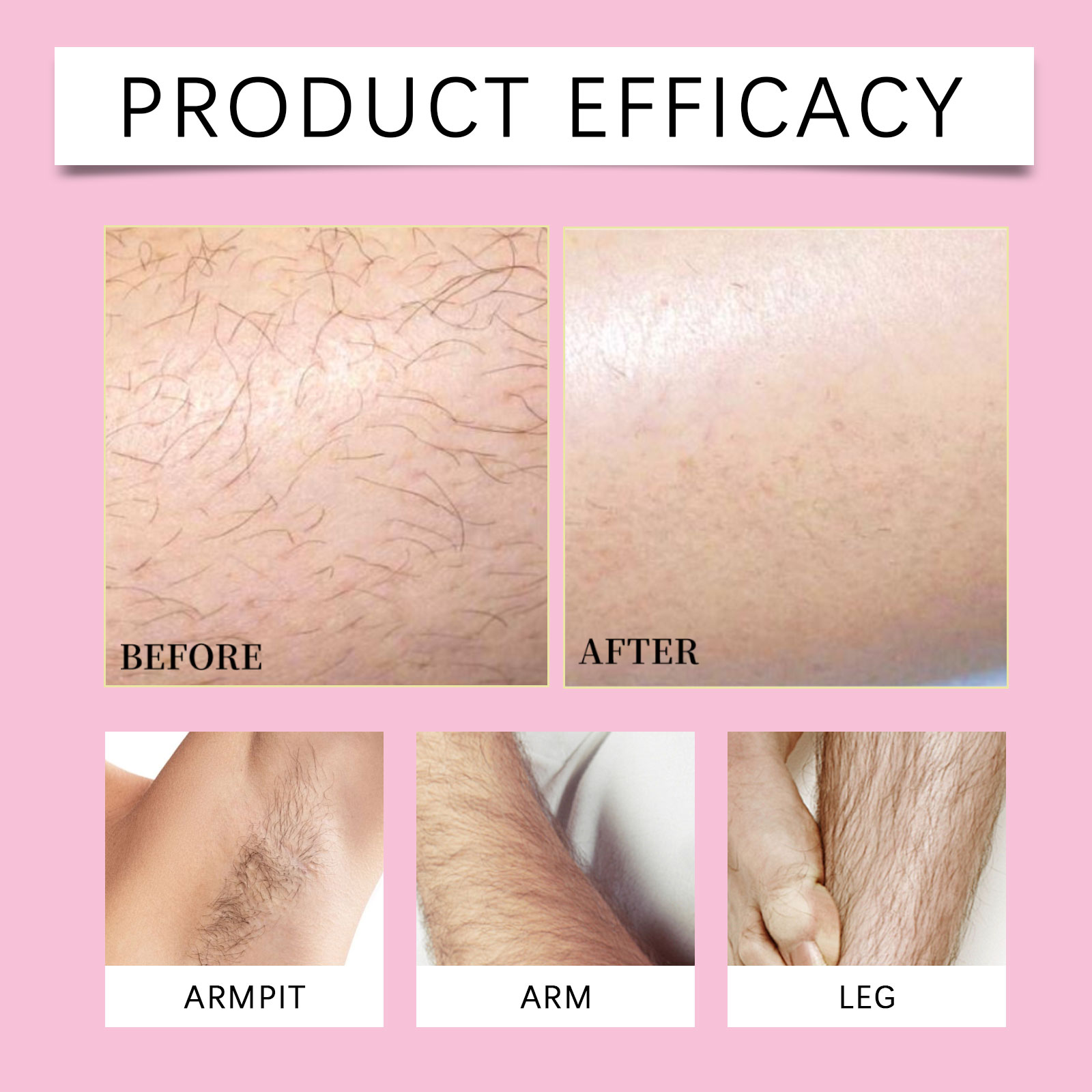 Body Hair Removal Cream Mild Nourishing Repair Beauty Skin Care Preparation For Limb Armpit Whole Body Skin Depilation Treatment Exclusive