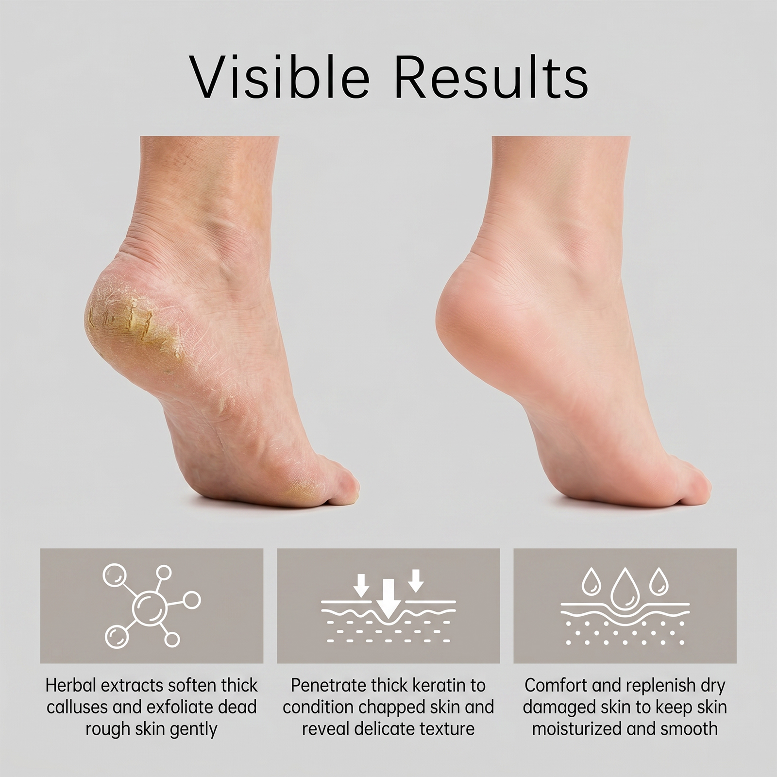 Skin Care Gel Mild Moisturizing Deep Hydrating Humectant Soft Refined Rough Hard Skin Complexion Tissue Surface
