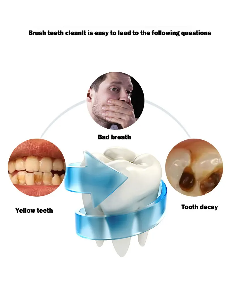 (White) U-Type Toothbrush 360 Degrees Intelligent Silicon Head Sonic Electric Toothbrush Automatic USB Charge Waterproof Toothbrush