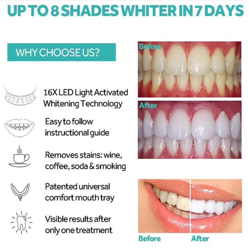 Teeth Blue Light Whitening Kit Lamp Instrument Universal Interface Portable Rechargeable Blue Light Oral Care Lamp Tool