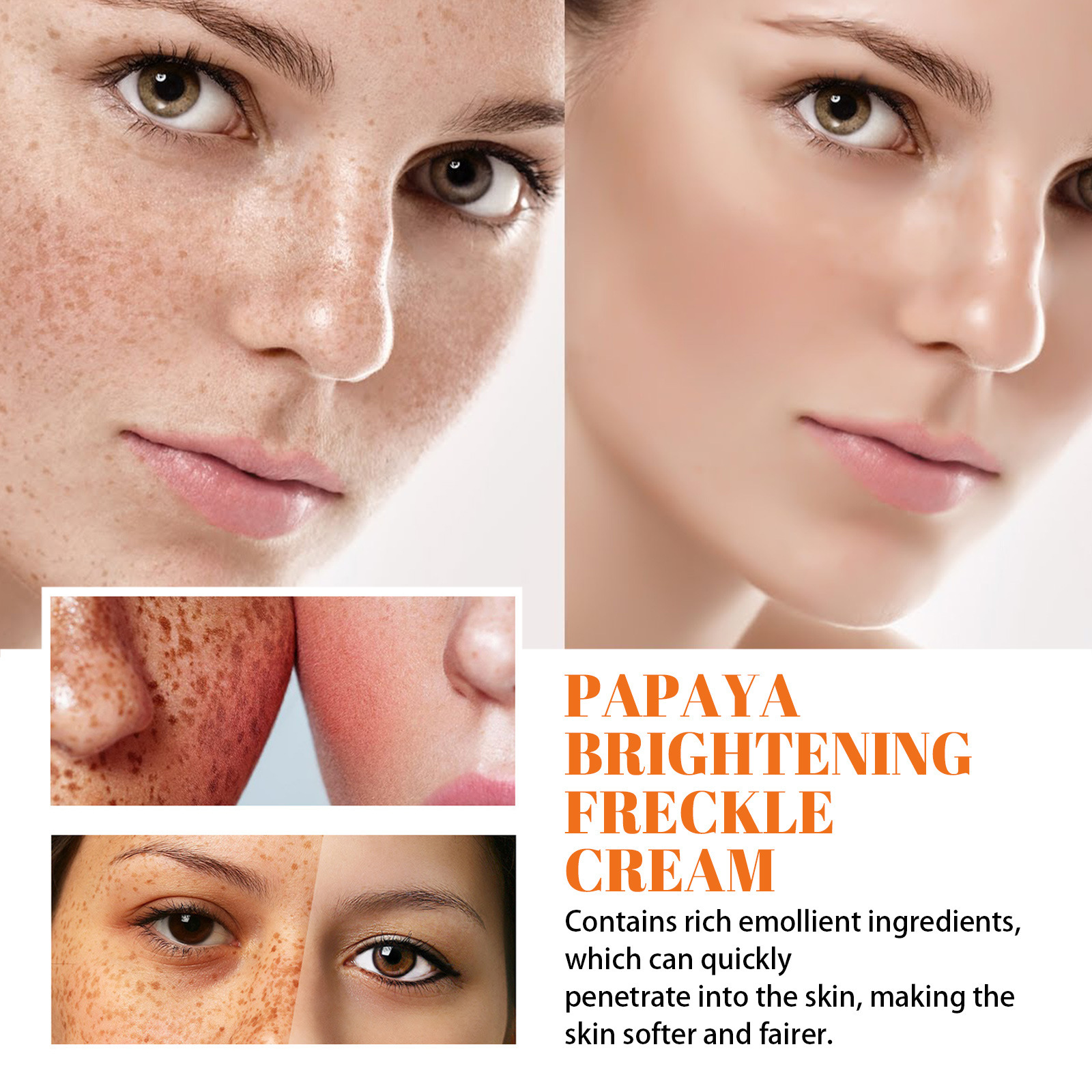Whitening Freckle Cream Melanin Blemish Remover Lighten Pigmentation Melasma Removal Whiten Nourish Dark Spot Corrector Cream Day Night Cream