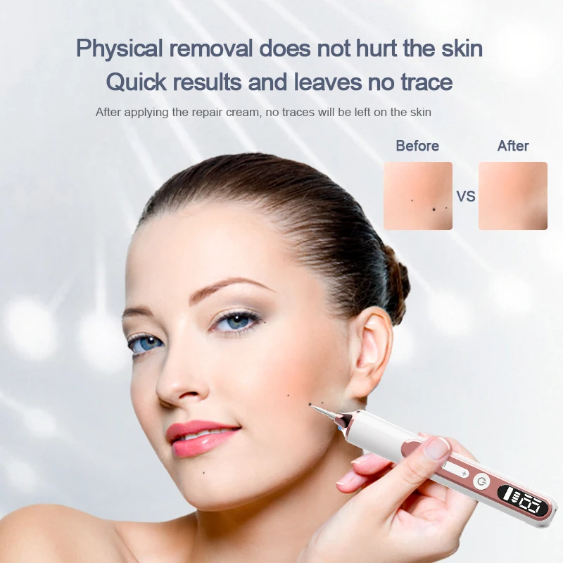 Black Dots Remover by Plasma Pen Beauty Skin Care Products Skin Tag Removal Face Cleaning Tools Tattoo Freckle Dark Spot Mole Warts Eliminator Machine