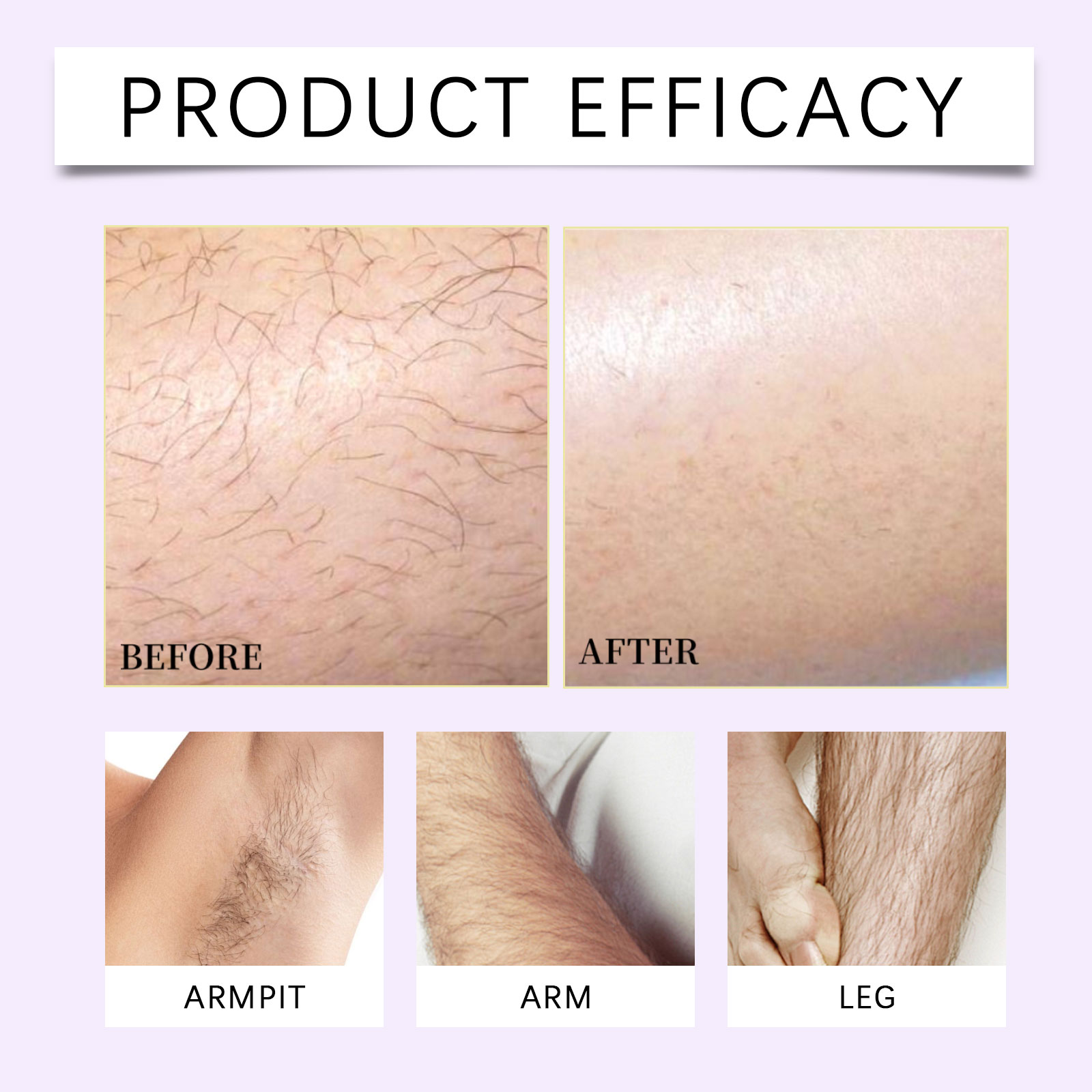 Gentle Soothing Hair Removal Mousse Fine Foam Easy To Clean Moisturizing For Whole Body Multiple Areas