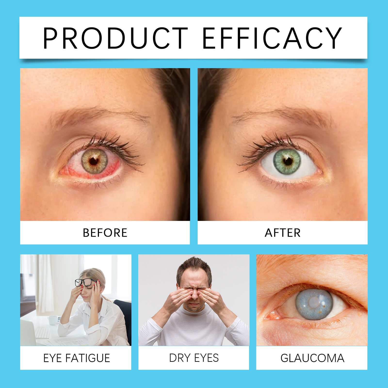 Eye Care Drops Gently Protect Eye Skin Refreshing Moisturizing Hydrating Portable Eye Drops