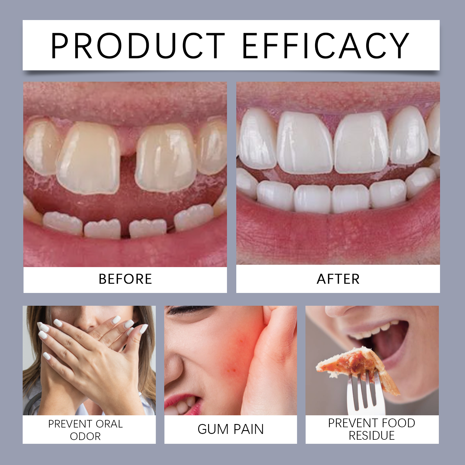 Denture Fixing Adhesive Improves Comfort Protects Loose Dentures Bonding Stabilizing Cream For Dental Use