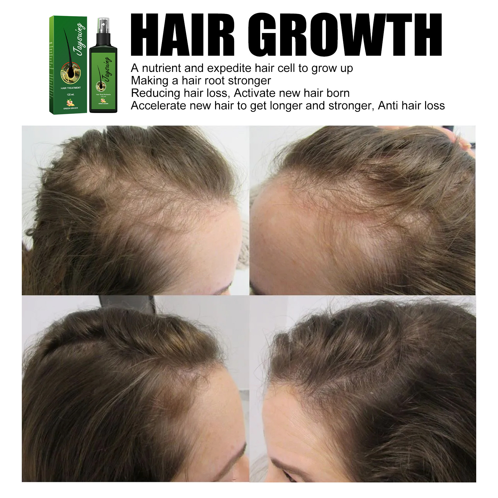 (30ml) Hair Growth Serum Hair Lotion Ginger Serum Hair Spray Anti Loss Promotes Thicker Natural Nourishing Hair Care for Men Women
