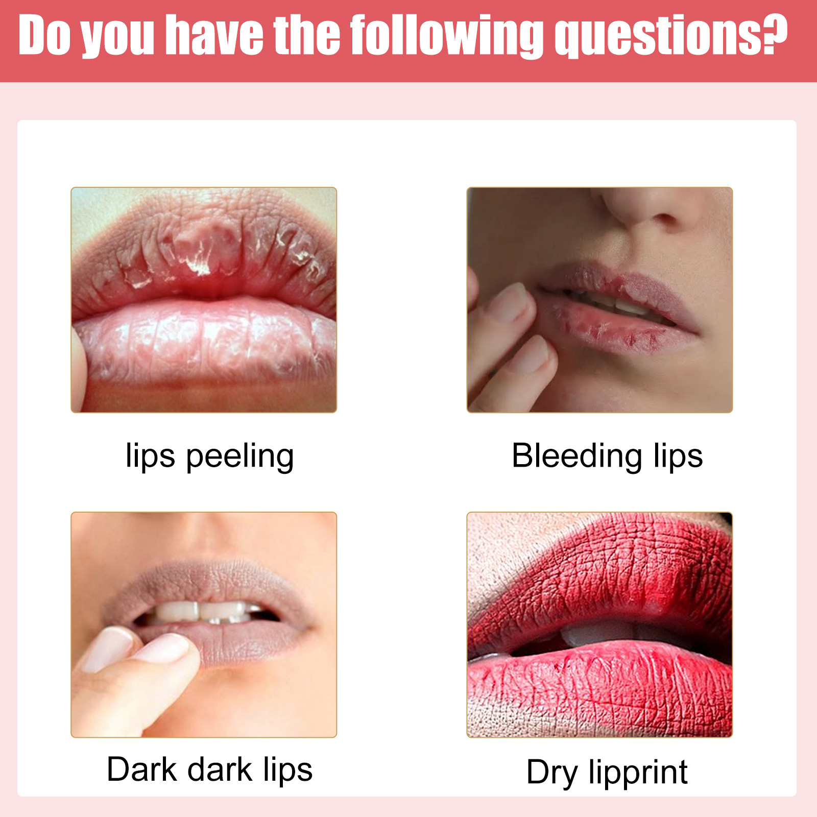Lip Lightening Lips Cream Pink Fresh Bleaching Treatment Lip Balm Whitening Hydrating Lip Moisturizer Lip Care 30g