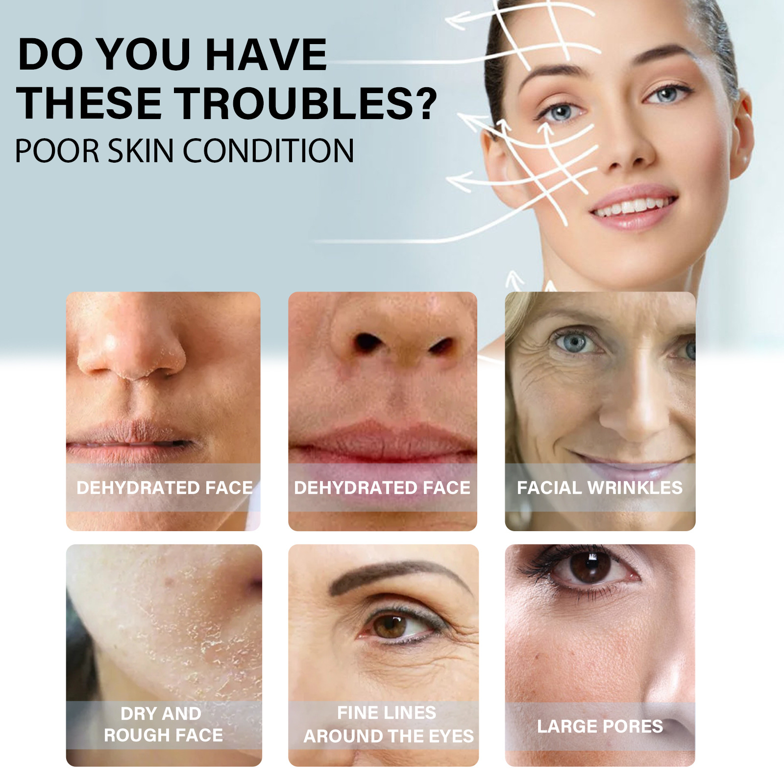 Protein Thread Lifting Face Filler Protein Line Hydrolyzed Collagen Absorbable Smoothing Firming Moisturizing Tightening Anti-wrinkle