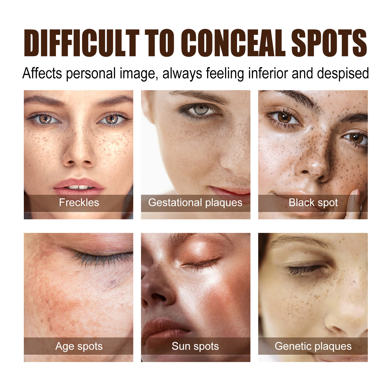 (1 PC) Freckle Remover Cream Melanin Correcting Pigmentation Remover Fade Dark Spots Improve Dull Skin Brightening Face Cream Skincare