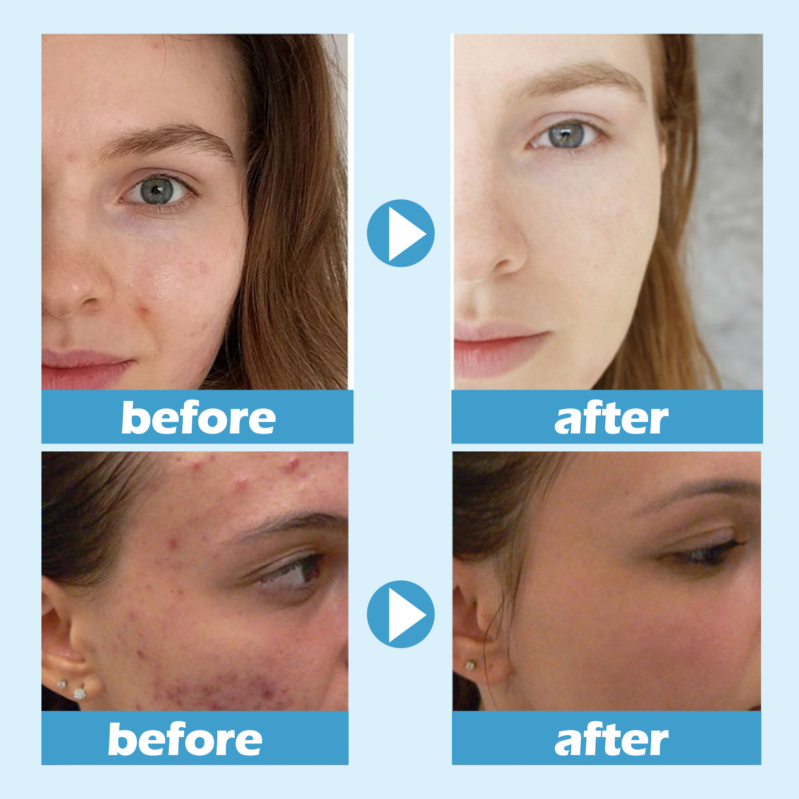 (1 PC) Hydrating Sleeping Mask Hydrating Nourishing Facial Mask Deep Cleansing Pores Acne Treatment Soothing Repair Moisturizing Pores Shrinking