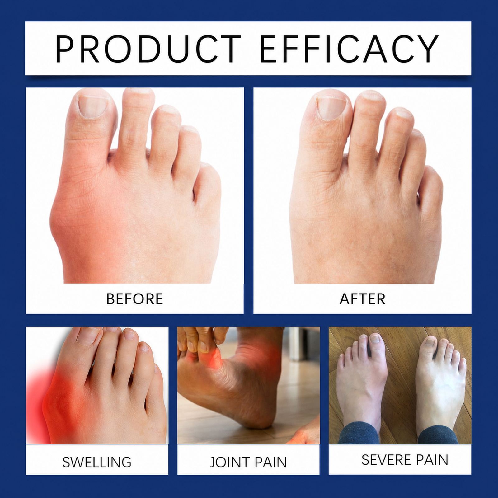 Toe Corrector Daily Care Comfortable Wearing Fit Toe Protector Orthopedic Hallux Valgus Foot Nursing Appliance