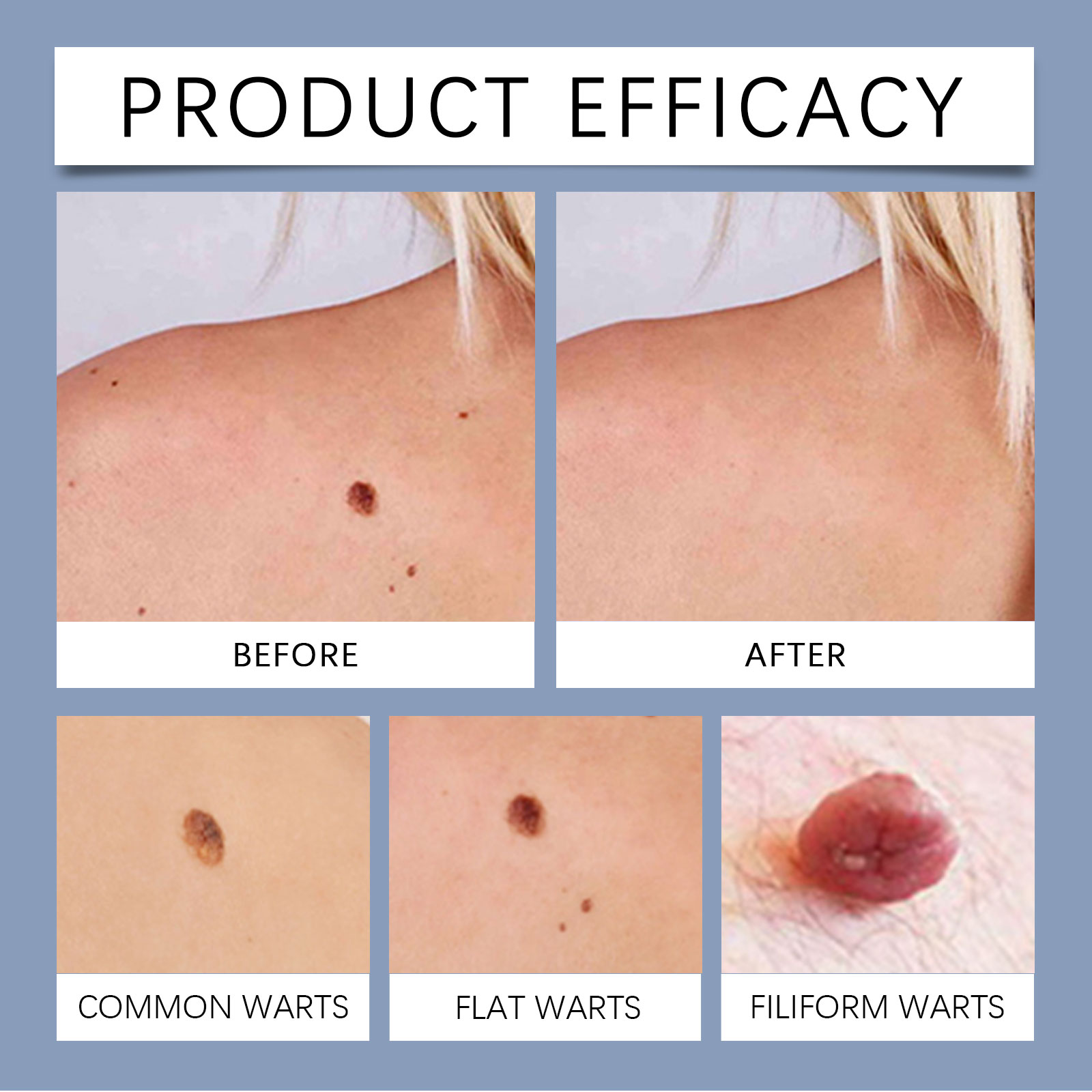 Body Care Patch Plant Ingredient Breathable Thin Fit Skin Local Care Long Standing Sitting Suitable