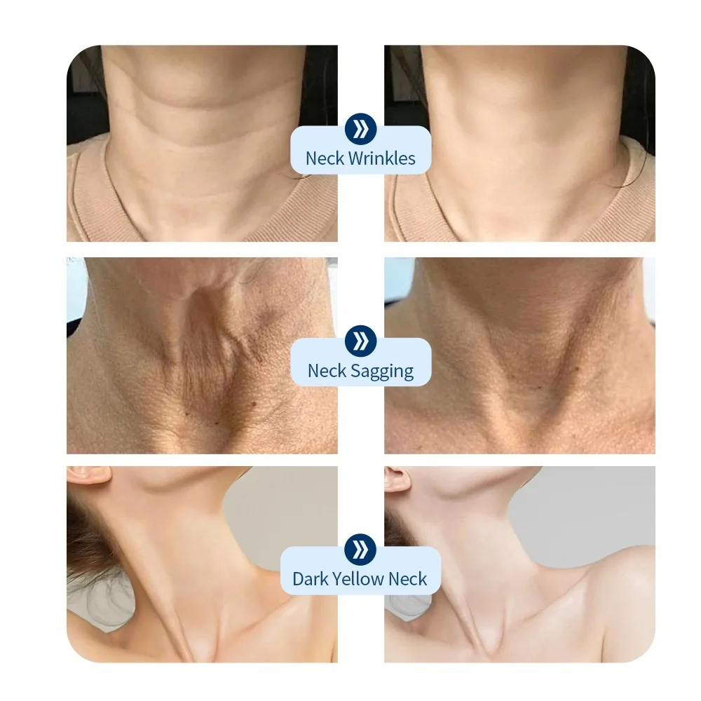 Neck LED Mask 7 Colors Photon Neck Beauty Mask Neck Wrinkle Remover Skin Rejuvenation Tightening Brightening Lifting Device Anti Wrinkle Skin Care