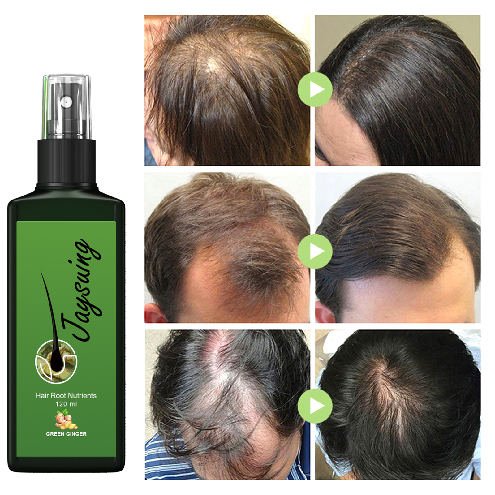 (30ml) Hair Growth Serum Hair Lotion Ginger Serum Hair Spray Anti Loss Promotes Thicker Natural Nourishing Hair Care for Men Women