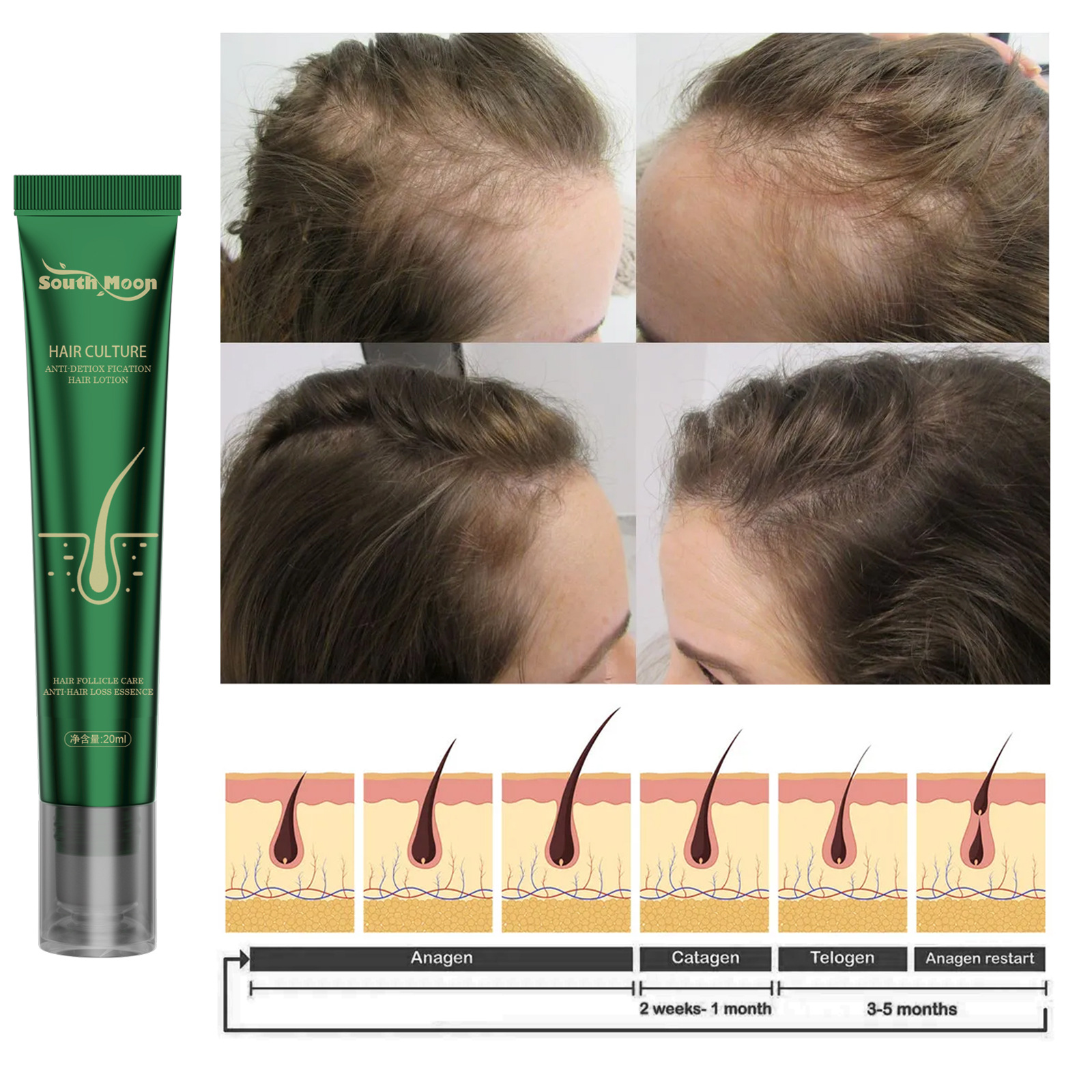 Biotin Fast Hair Growth Oil South Moon Hair Regrowth Serum Hair Thinning Treatment Hair Growth Liquid Anti-loss for Women Men 20ml