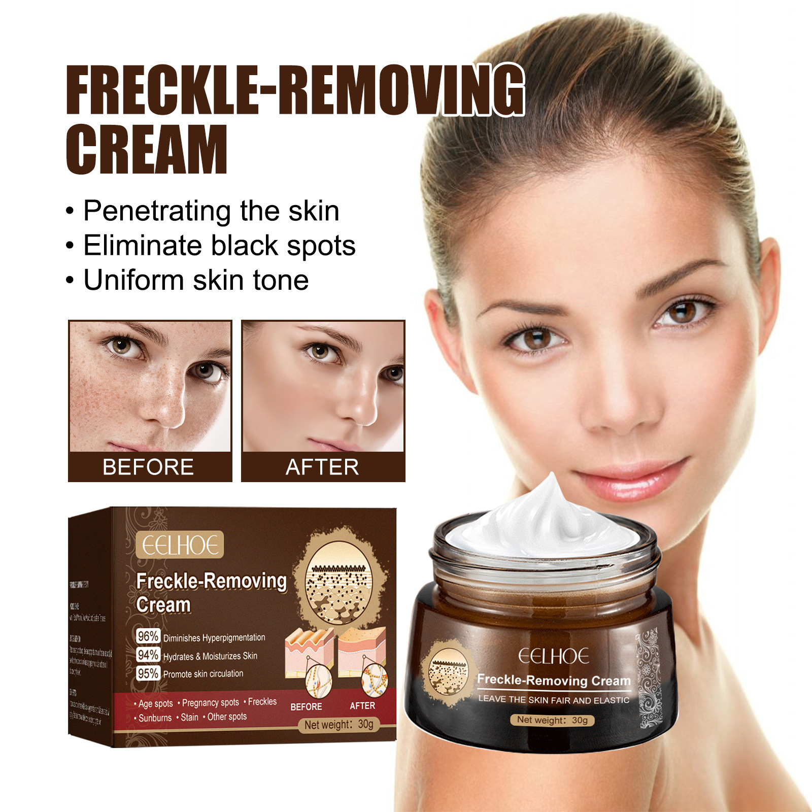 Freckle-Removing Cream Spot Off Freckle Whitening Fades Spots and Brightens Skin Tone Dark Spot Remover Moisturizing Skin Care
