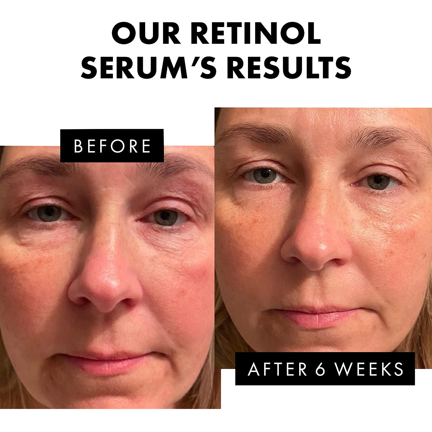 Retinol Firming Cream for Skin Care Vitamin E Retinol Face Cream Fade Fine Lines Anti Aging Moisturizing Hydrating Nourishing 20ml