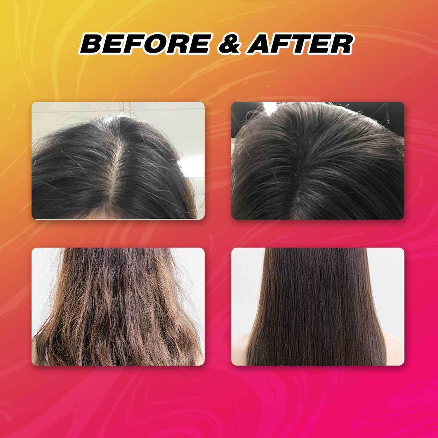 Batana Hair Strengthening Essence Moisturizing Nourishing For Thicker Fuller Hair Daily Scalp And Strand Treatment 15ml