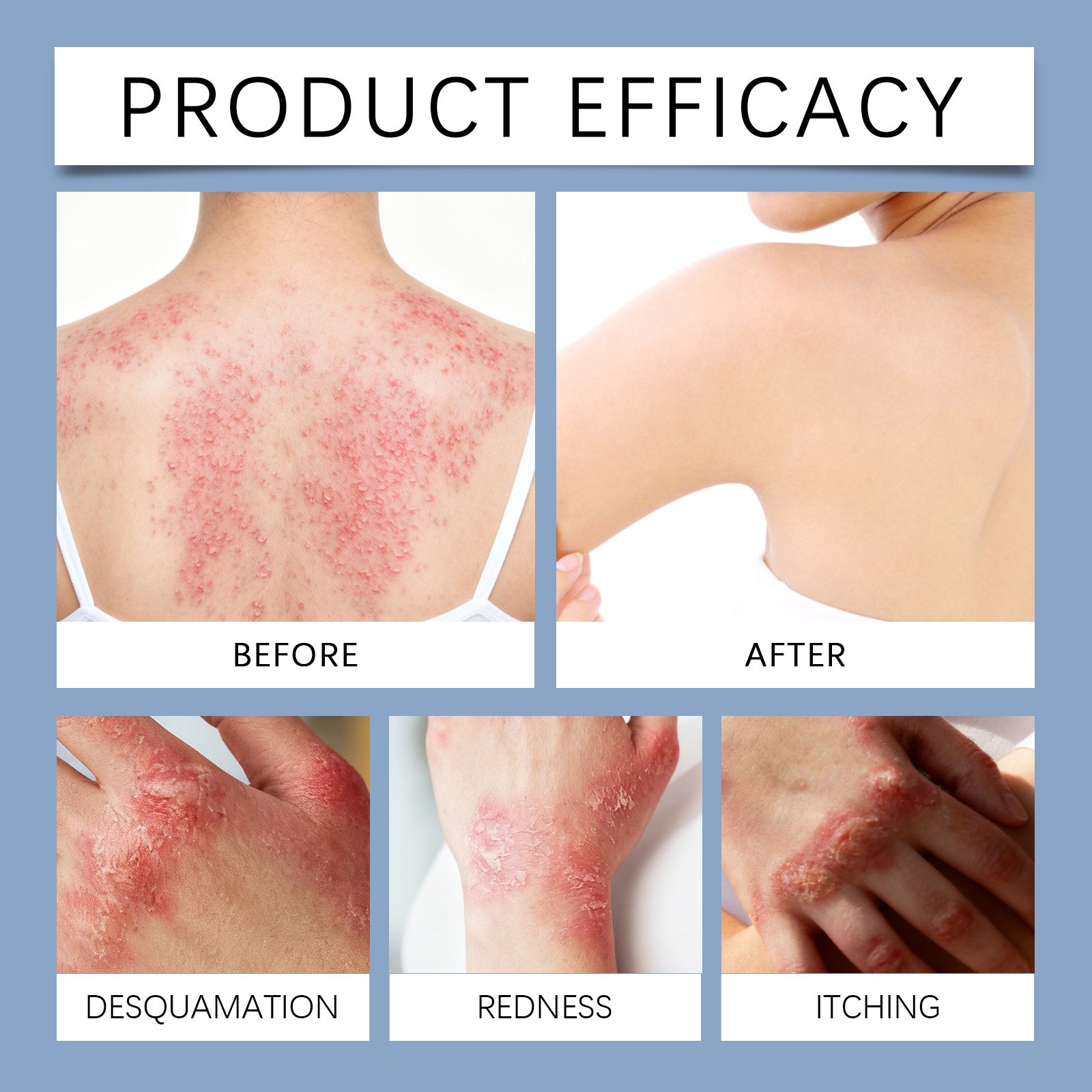 Magnesium Herbal Care Spray Mild Formula Refreshing Hydrating Soothing Comfort Skin Daily Treatment