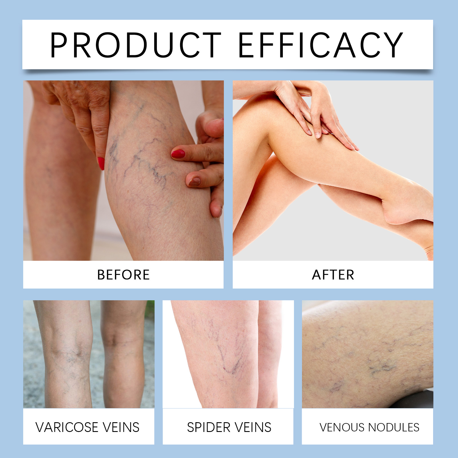 Leg Care Spray Cool Soft Moist Daily Skin Care For Office Long Sitting Legs