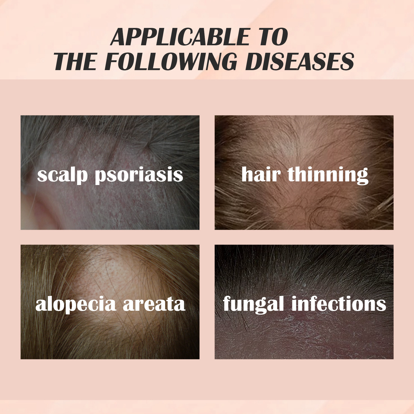 Hair Serum Psoriasis Dandruff Treatment for Scalp Oil Anti Itching Follicle Booster Stimulator Moisturizes Smoothing Nourishing
