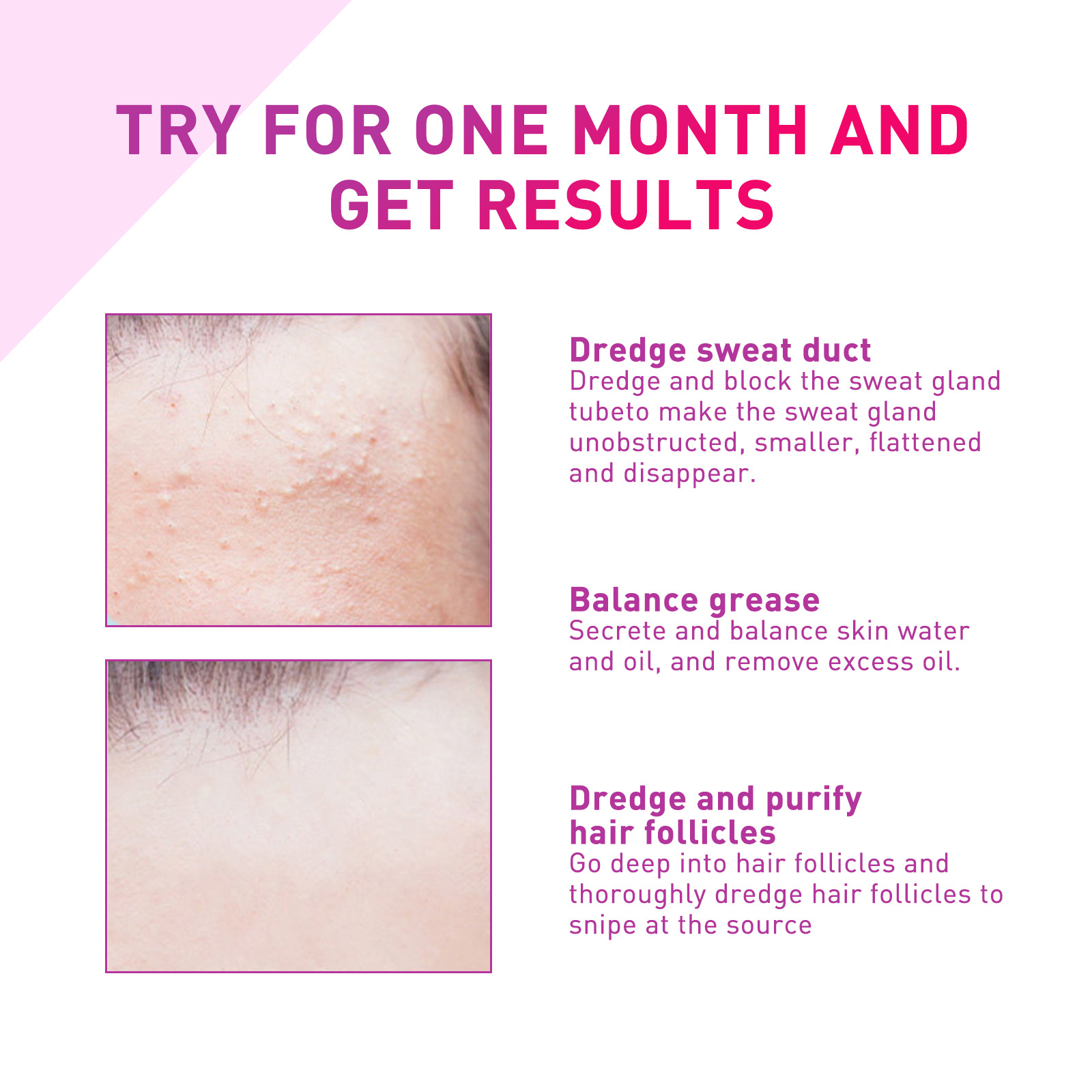 (1 PC) Fat Granules Removal Eye Serum Milia Spot Treatment Puffiness Repair Fine Lines Eye Bag Oil Control Moisturize Essence Eye Skin Soothing Remove Particles Around the Eyes
