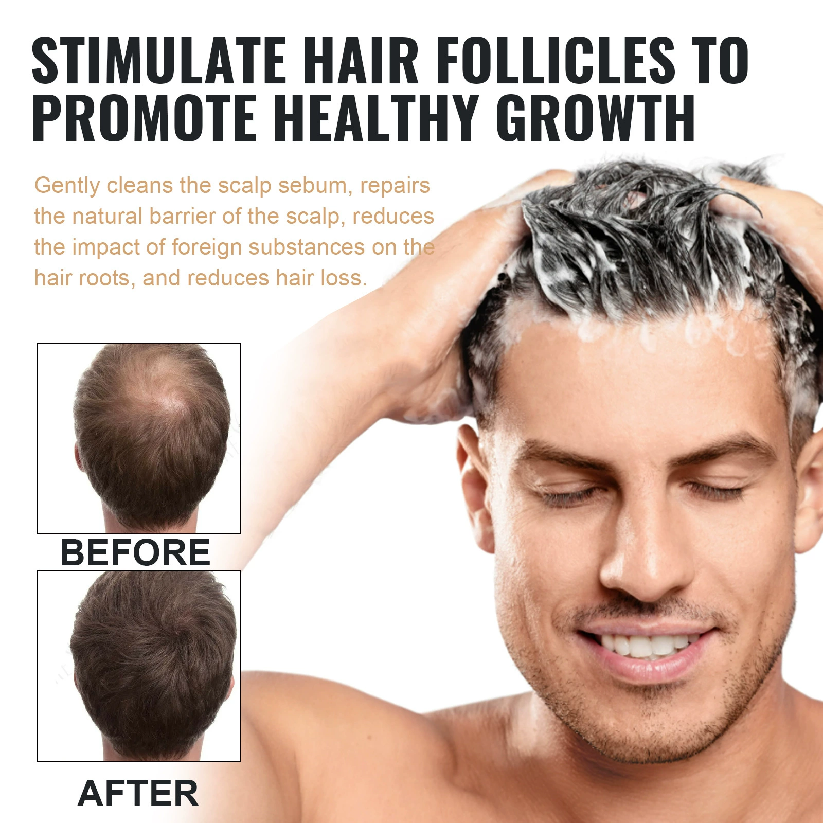 Shampoo for Fast Hair Growth Repair Nourishment Root 100ML