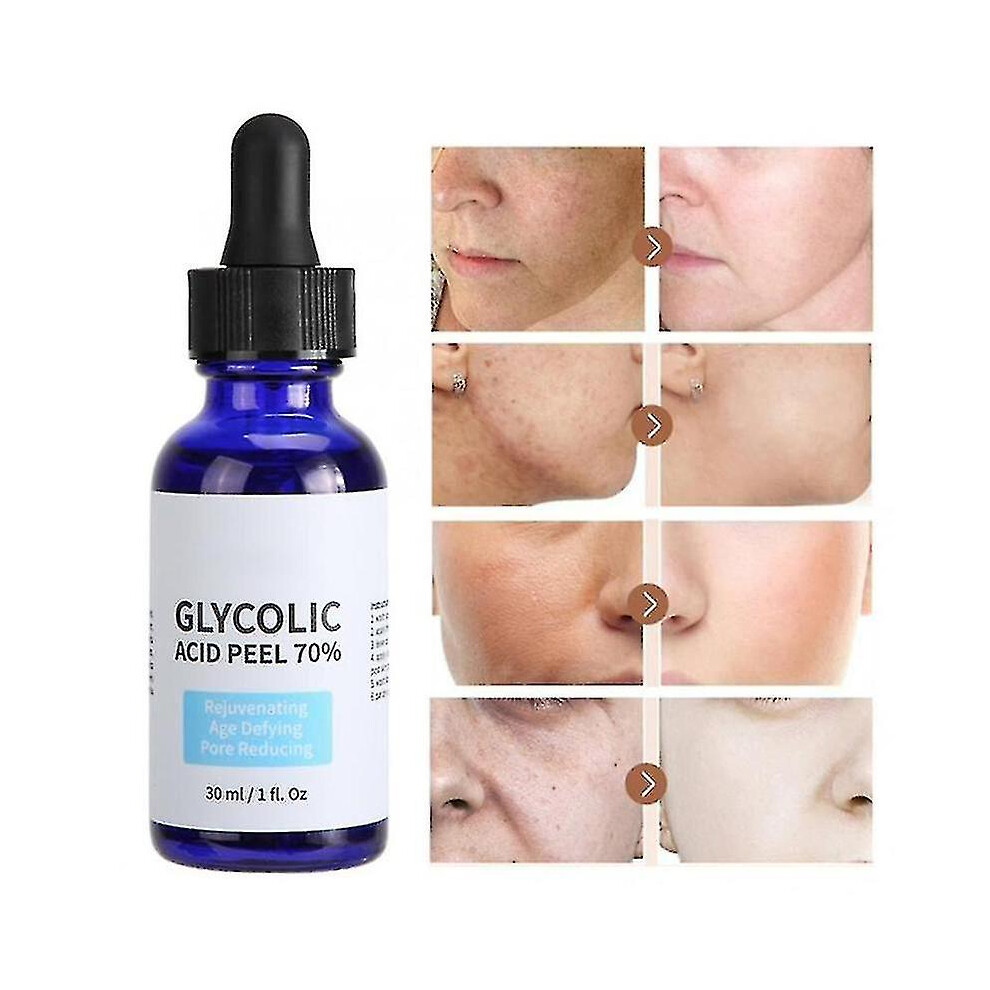 Glycolic Acid Peel Purity 70 Concentration 5 Skin Repair Invisible Pores Brighten Skin Tone Treat Acne Mild And Non-irritating-mxbc