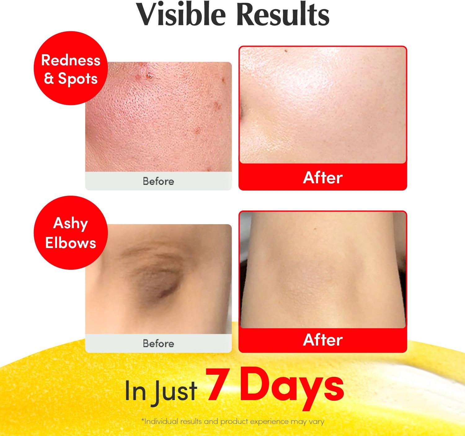 EQQUALBERRY Vitamin Illuminating Serum 30 ml Vitamin C Niacinamide Face Serum with Arbutin Ceramides Hyaluronic Acid Hydrating Radiance-Support Serum Skin Care