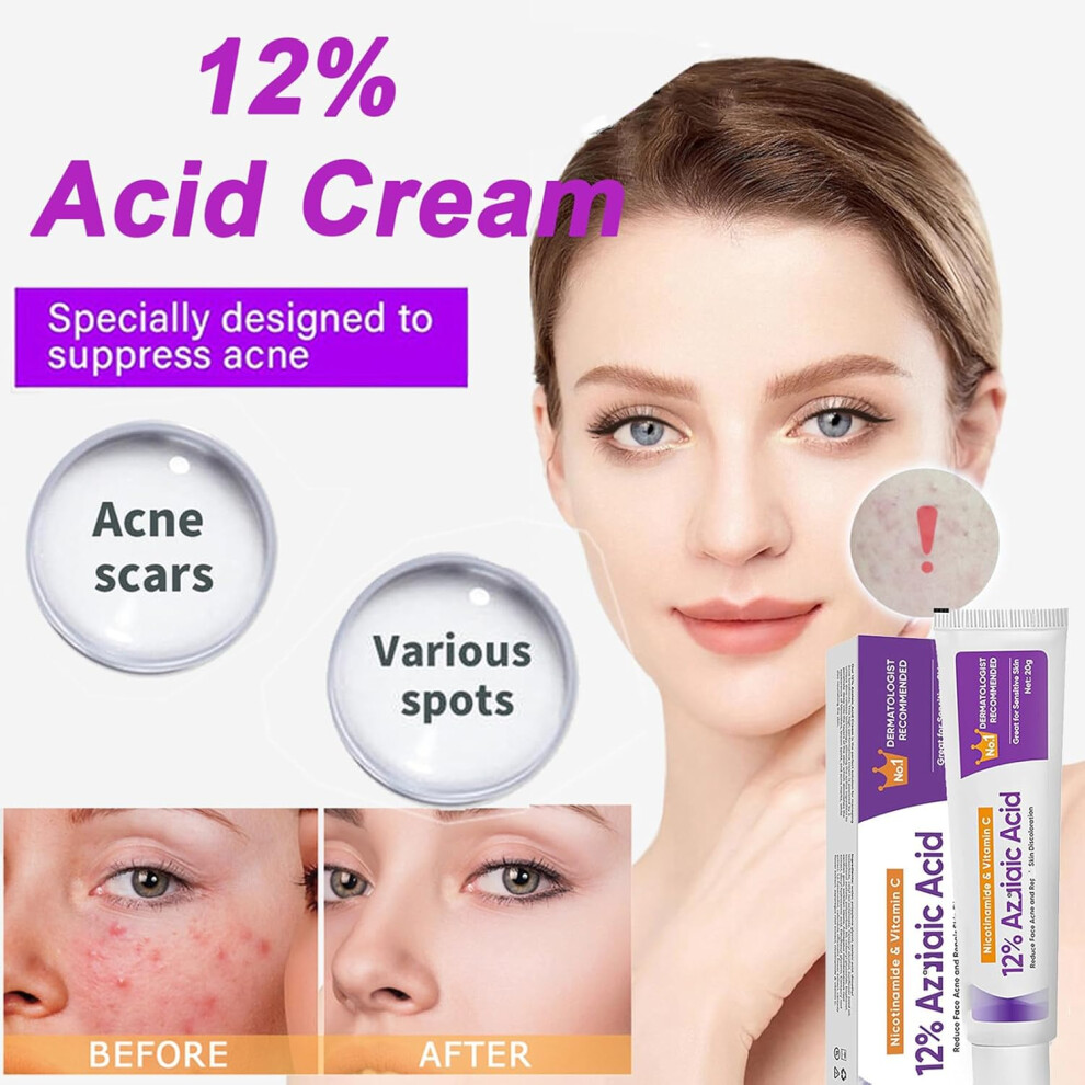 Nicotinamide Vitamin C 12 Percent Azelaic Acid reduce Acne Repair 20g