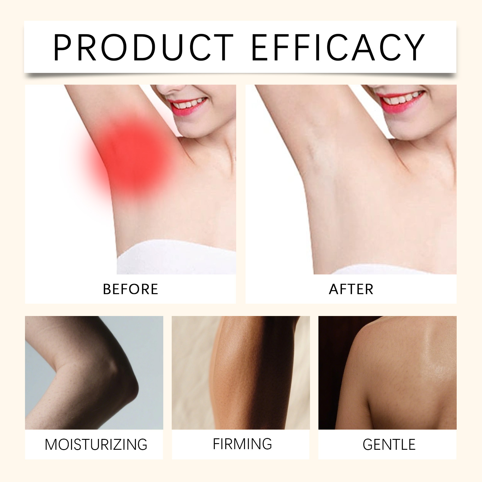 Skin Anti Friction Balm Stick Moisturizing Calming Daily Care For Legs Heels Arms Relieve Rub Discomfort