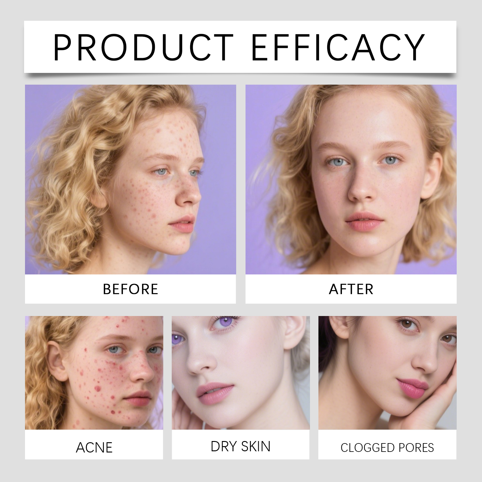 Acne Patch Hydrocolloid Material Skin Friendly Invisible Breathable Facial Acne Concealer Sticker
