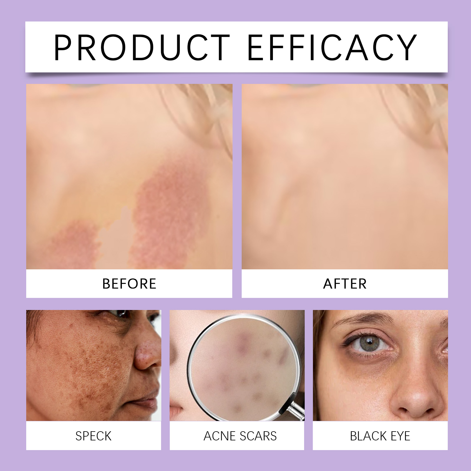(Dark Skin) Concealer Palette Daily Care Lightweight Fit Moisturizing Nourish Skin Sheer Concealer Plate