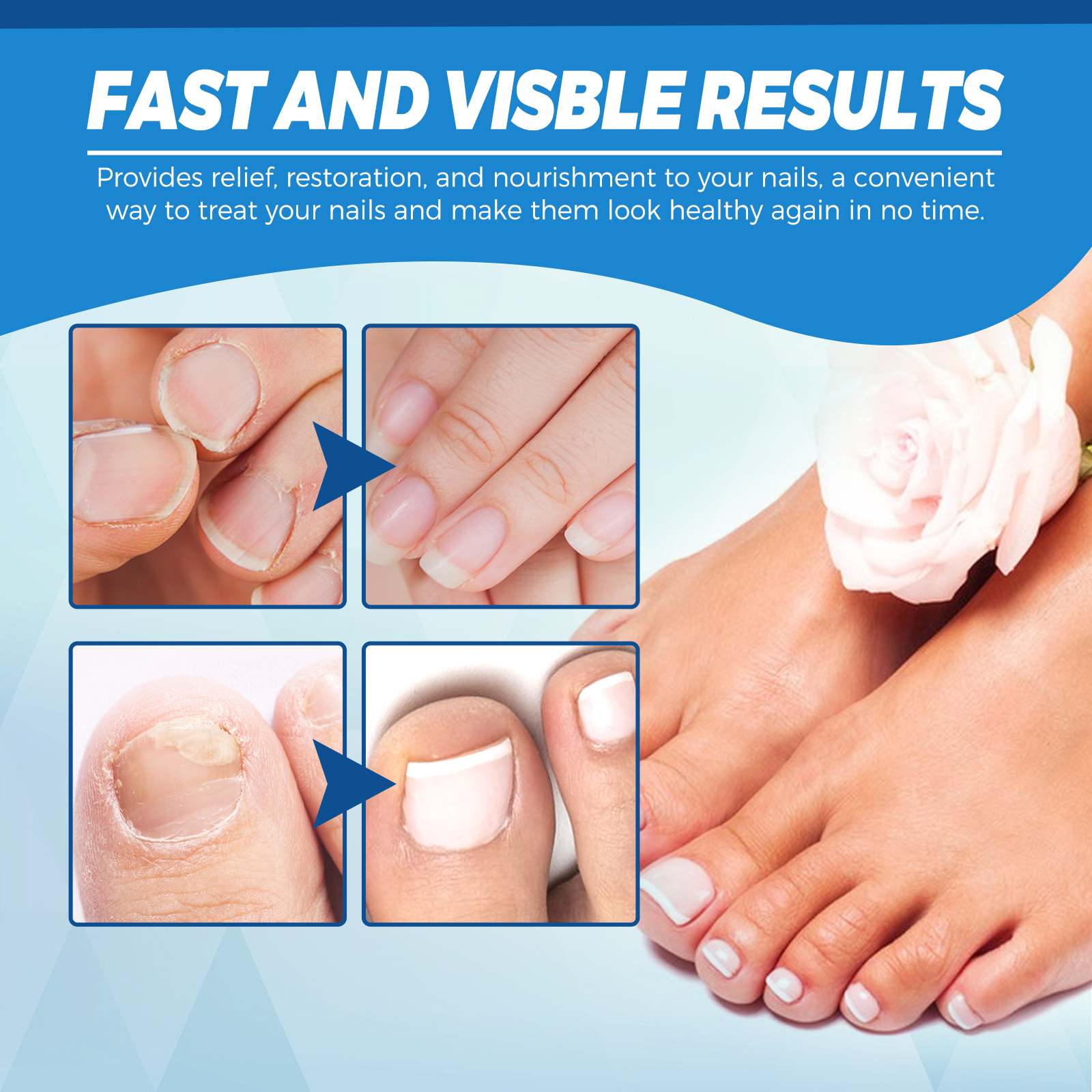 Blue Light Nail Care Pen Gentle Portable Device For Nail Health Maintenance And Fungal Care Home Use