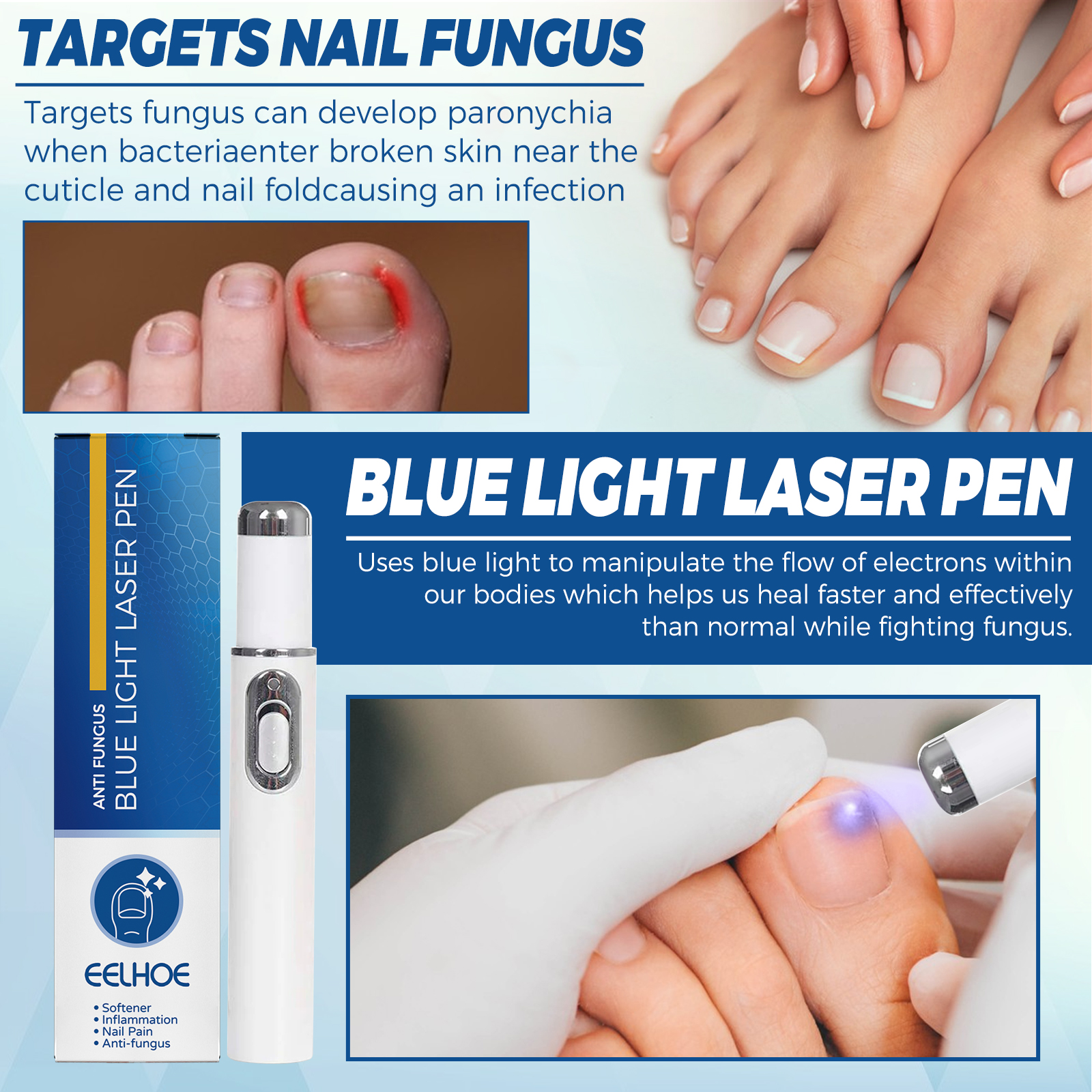 Blue Light Nail Care Pen Gentle Portable Device For Nail Health Maintenance And Fungal Care Home Use