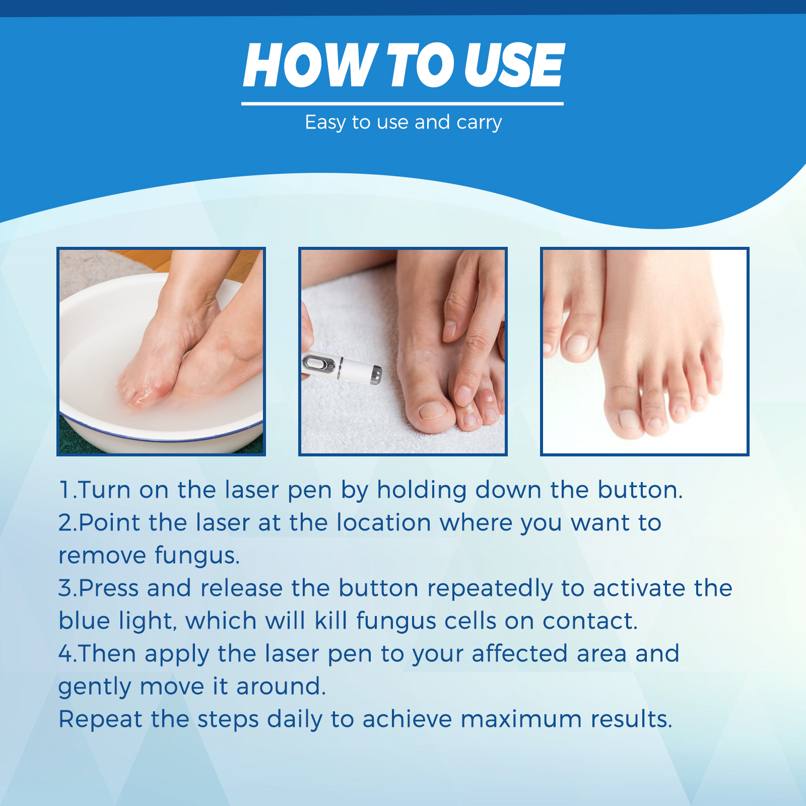 Blue Light Nail Care Pen Gentle Portable Device For Nail Health Maintenance And Fungal Care Home Use