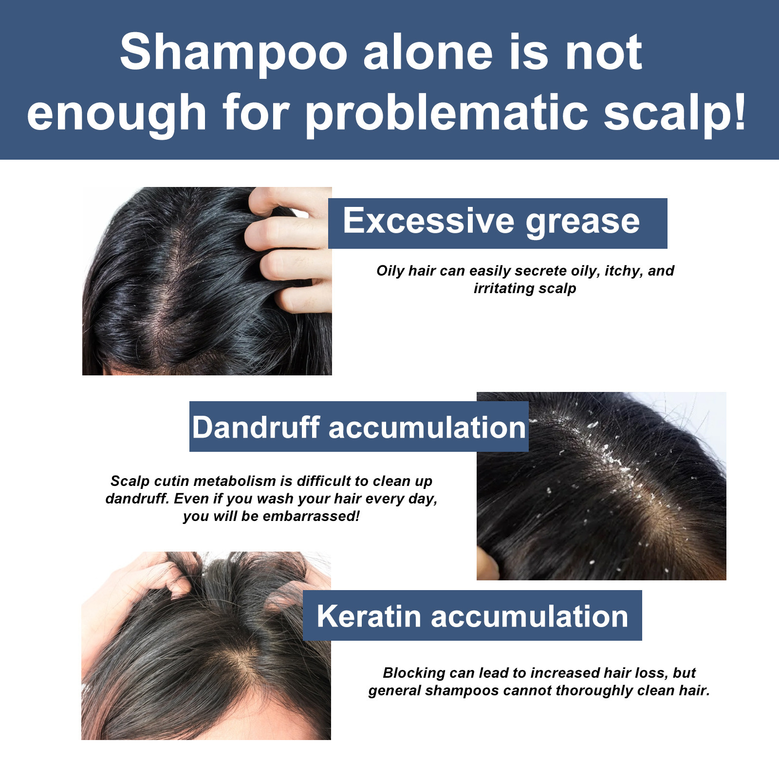 Scalp Exfoliating Scrubs Hair Scratcher Scalp Oil Nutritional Effectively Repairs Damaged Dry Hair Restore Smoothness Promote Scalp Cleanse Treatment