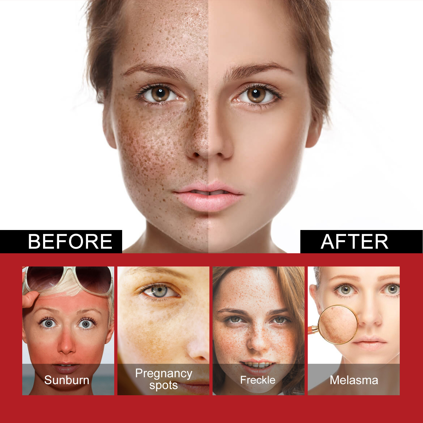 Dark Spots Corrector Anti Dark Spot Cream Whitening Facial Cream Repair Fade Freckles Melanin Remover Brighten Moisturizing Improving Facial Dullnes