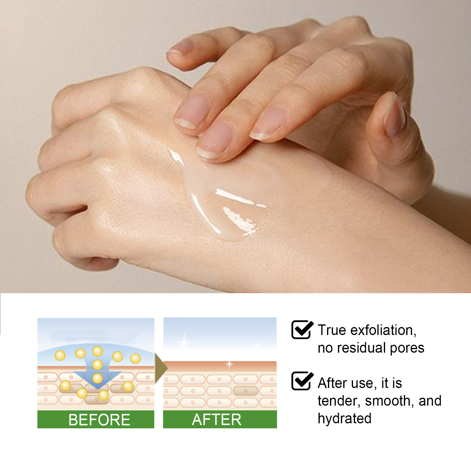 Aloe Exfoliator Gel Face Exfoliating Cream Shrink Pore Blackhead Acne Treatment Scrubs Dead Skin Removal Smooth Whitening Moisturizing Peeling Gel