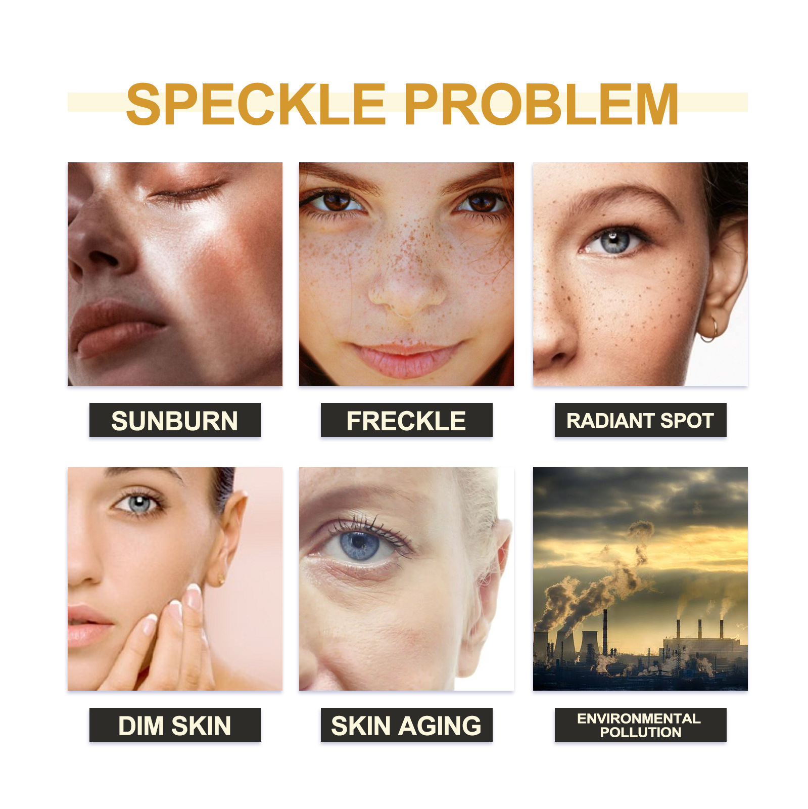 Brightening Face Cream Freckl-e Removal Lightening Dullness Fade D-ark S-pot C-hloasma Skin Firming Moisturizing M-elasma Cream
