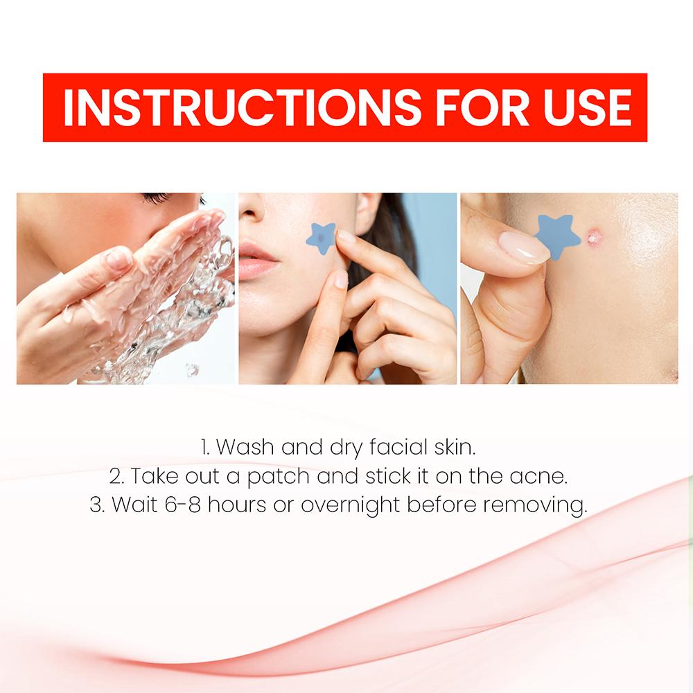 (star) Star Pimple Patch 200pcs Set Acne Invisible Acne Removal Stickers Acne Treatment Pimple Remover Concealer Face Spot Beauty Face Skin Care Makeup Tools