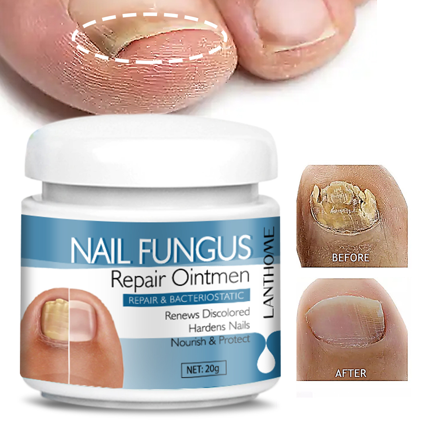Nail Repair Balm Moisturizing Strengthening For Brittle Damaged Nails Daily Home Manicure Cuticle Care Treatment 20g