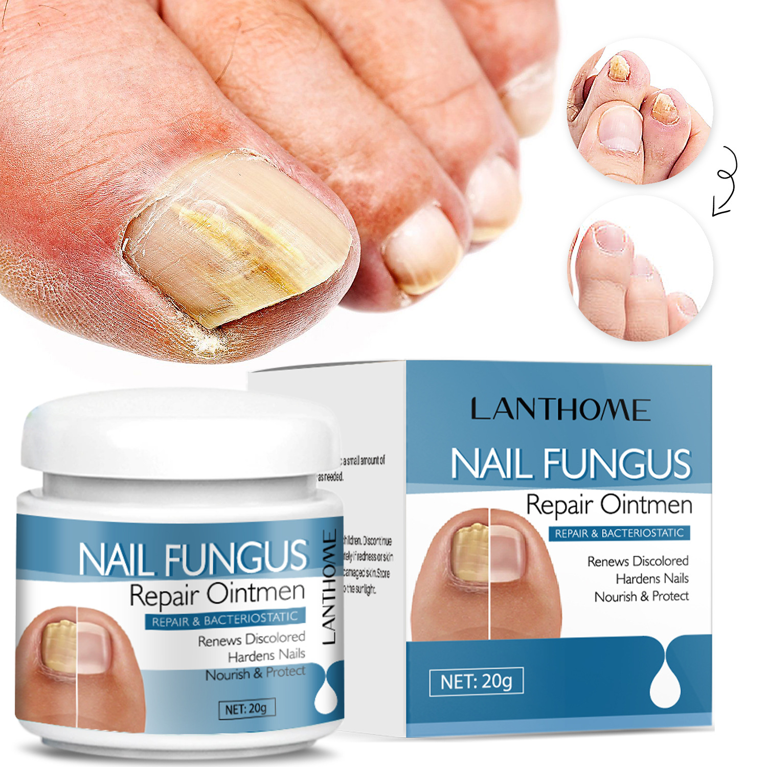 Nail Repair Balm Moisturizing Strengthening For Brittle Damaged Nails Daily Home Manicure Cuticle Care Treatment 20g