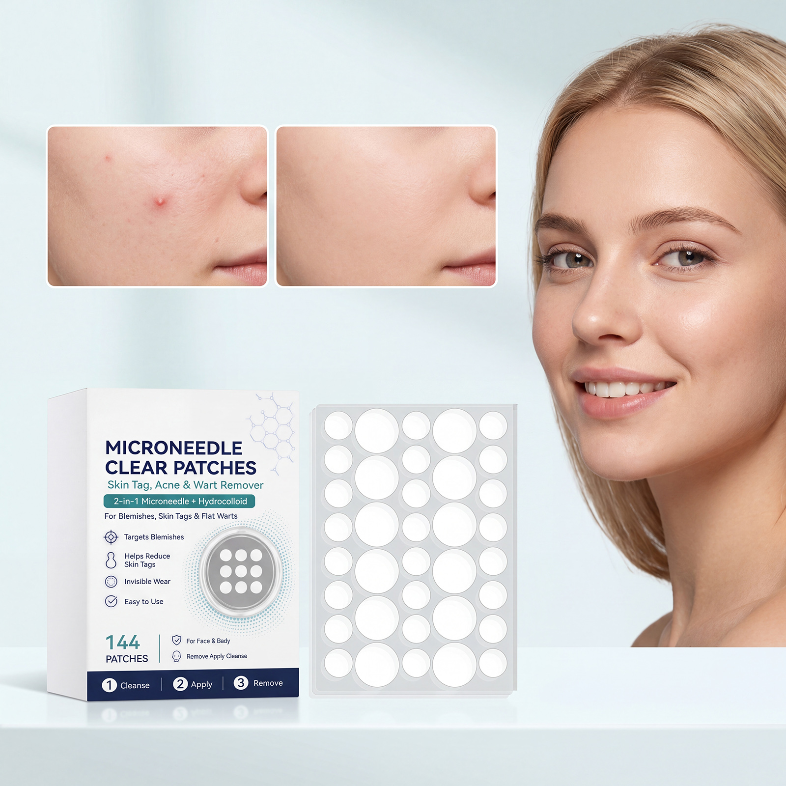 Acne Microneedle Patch Contains Salicylic Acid Tea Tree Oil Dissolve Grease Protect Skin Barrier Thin Invisible Day Night Use