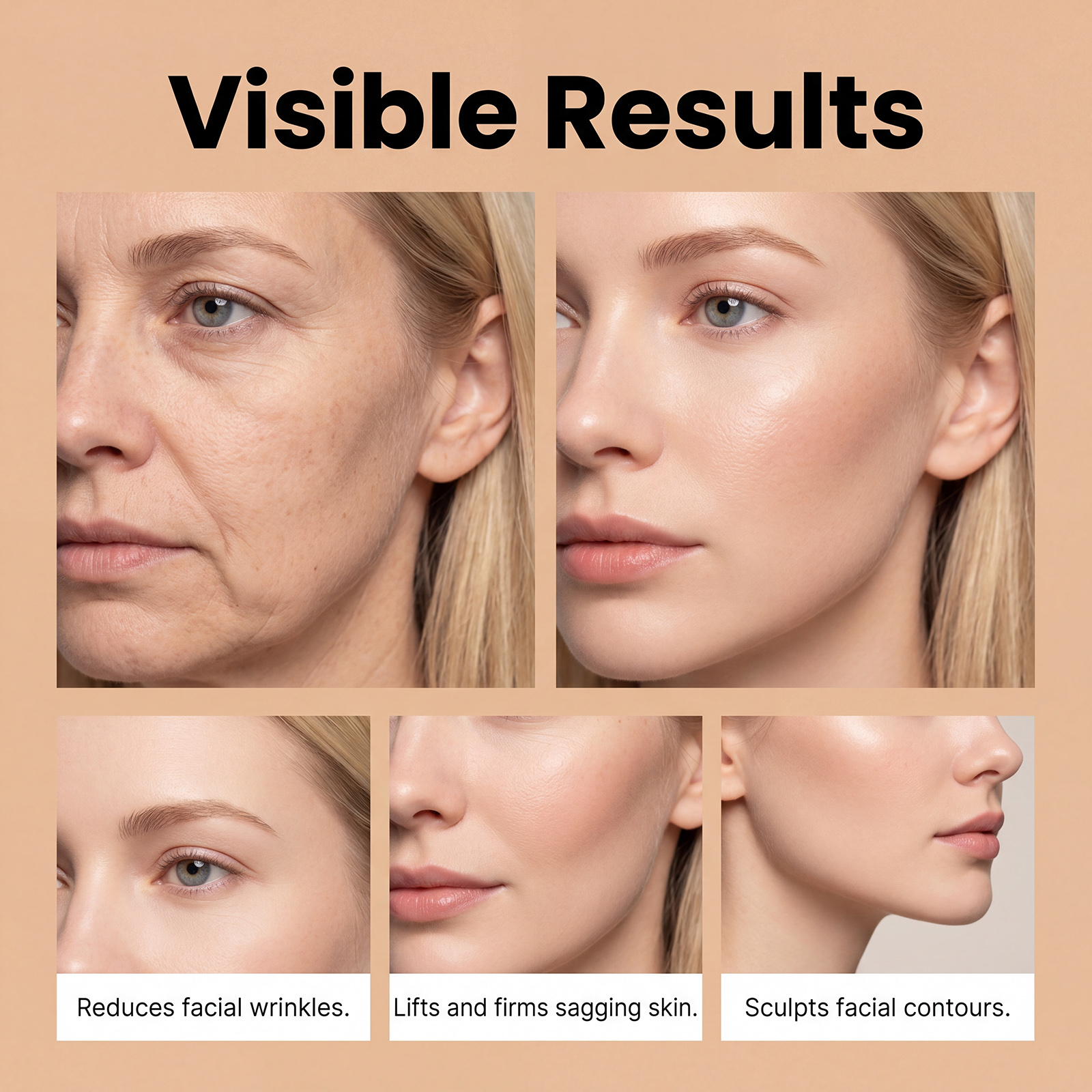 Acne Microneedle Patch Contains Salicylic Acid Tea Tree Oil Dissolve Grease Protect Skin Barrier Thin Invisible Day Night Use